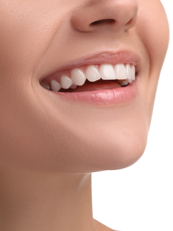filler-labbra-con-igiene-dentale-a-milano