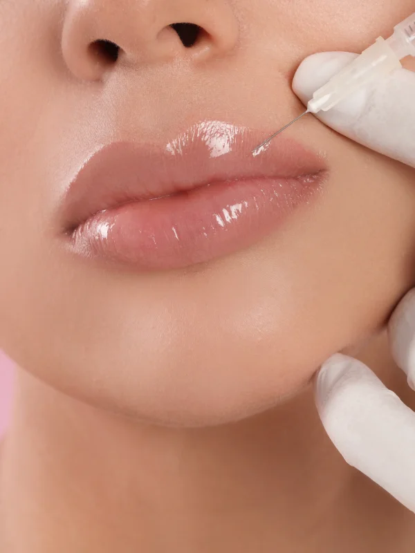 peeling-per-viso-e-sbiancamento-dentale-a-milano
